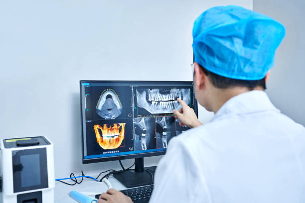 Best Emergency Wisdom Tooth Extraction in Bridgeport, WA