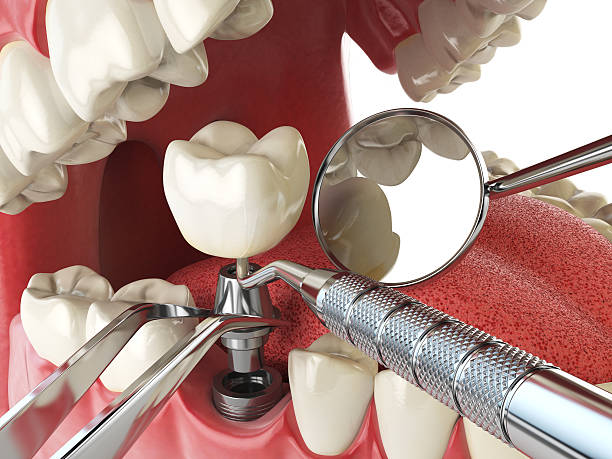 Best Walk-In Emergency Dental Services in Bridgeport, WA